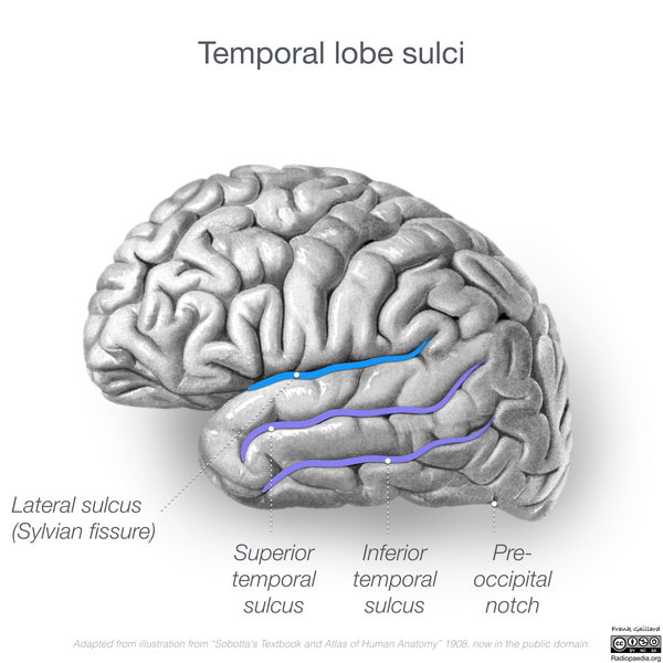 File:Neuroanatomy- lateral cortex (diagrams) (Radiopaedia 46670-51201 G 1).png