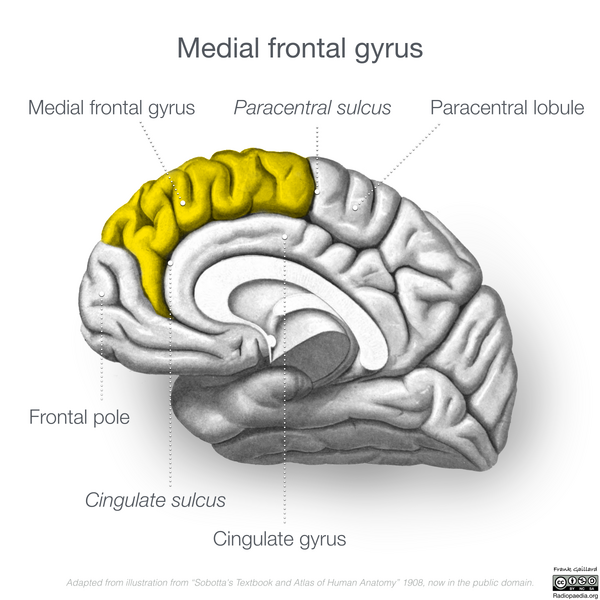 File:Neuroanatomy- medial cortex (diagrams) (Radiopaedia 47208-52697 Medial frontal gyrus 1).png