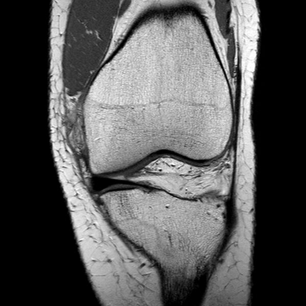 File:Anatomy Quiz (MRI knee) (Radiopaedia 43478-46874 A 10).jpeg