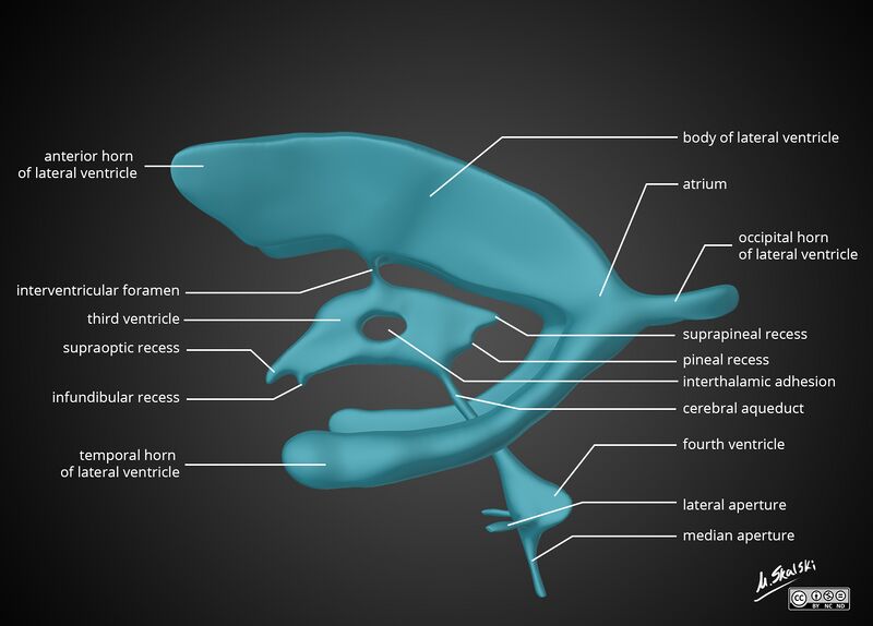 File:Brain ventricle anatomy diagram (Radiopaedia 37808-39727 None 1).jpg