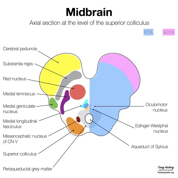 File:Brainstem arterial territories (diagrams) (Radiopaedia 81960-95925 Upper midbrain 1).jpeg