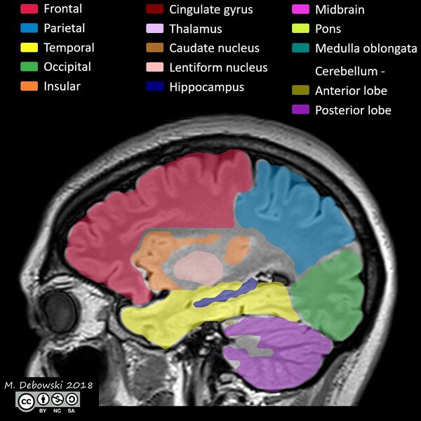 File:Brain lobes - annotated MRI (Radiopaedia 61691-69700 Sagittal 57).JPG