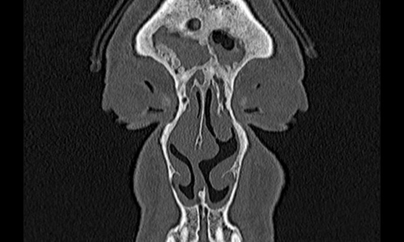 File:Chronic rhinosinusitis (Radiopaedia 65079-74075 Coronal bone window 7).jpg