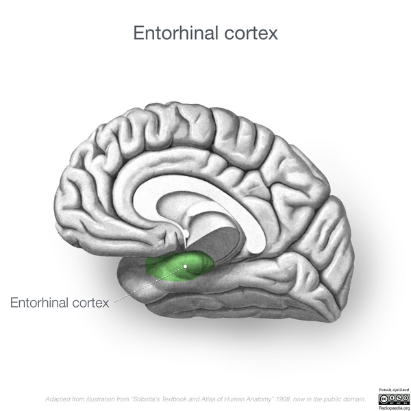 File:Neuroanatomy- medial cortex (diagrams) (Radiopaedia 47208-52697 Entorhinal cortex 2).png