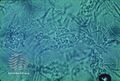 Malassezia microscopy (DermNet NZ fungal-pitver3).jpg