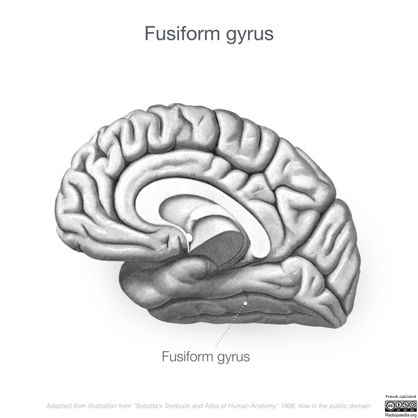 File:Neuroanatomy- medial cortex (diagrams) (Radiopaedia 47208-52697 Fusiform gyrus 7).png