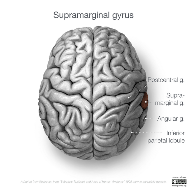 File:Neuroanatomy- superior cortex (diagrams) (Radiopaedia 59317-66671 Supramarginal gyrus 2).png