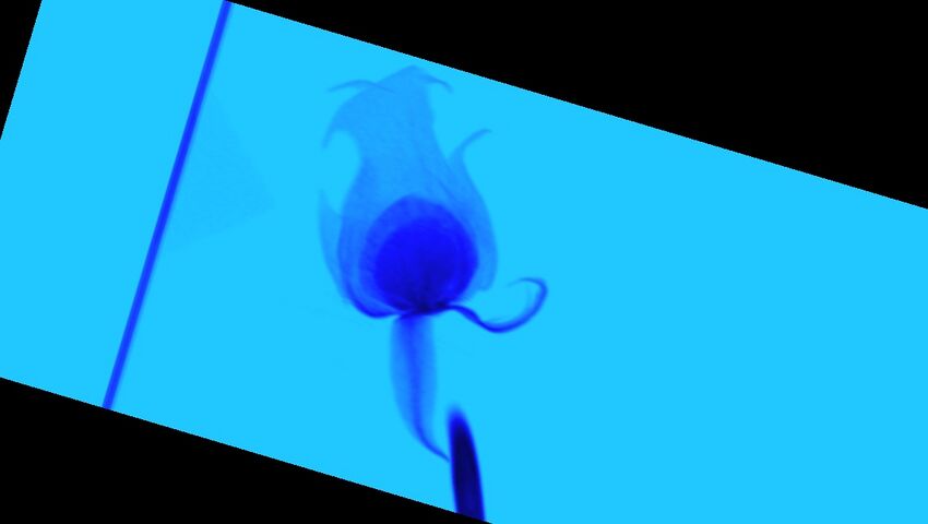 Blue rose (Radiopaedia 23430-23511 A 148).jpg