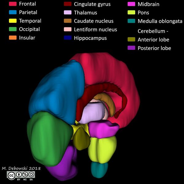 File:Brain lobes - annotated MRI (Radiopaedia 61691-69700 3D reconstruction 73).JPG
