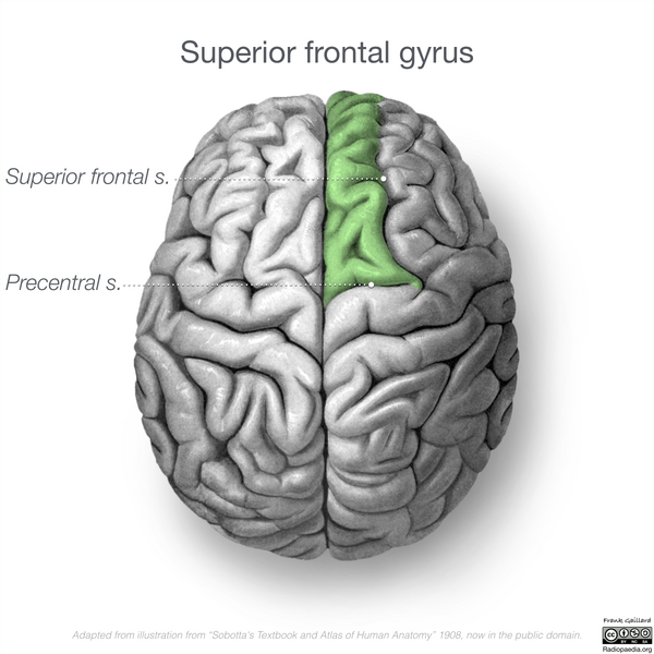 File:Neuroanatomy- superior cortex (diagrams) (Radiopaedia 59317-66670 B 3).png