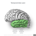 Neuroanatomy- lateral cortex (diagrams) (Radiopaedia 46670-51201 Temporal lobe 4).png
