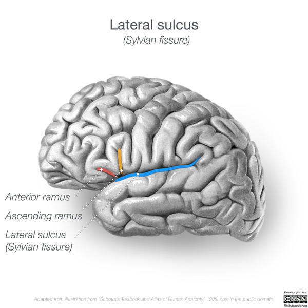 File:Neuroanatomy- lateral cortex (diagrams) (Radiopaedia 46670-51202 Lateral sulcus 2).png