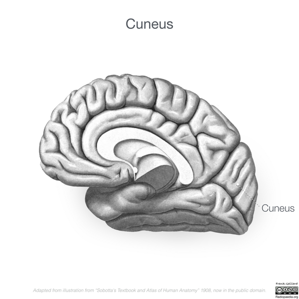 File:Neuroanatomy- medial cortex (diagrams) (Radiopaedia 47208-52697 Cuneus 7).png