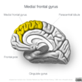 Neuroanatomy- medial cortex (diagrams) (Radiopaedia 47208-52697 Medial frontal gyrus 3).png