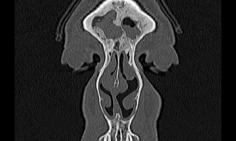 File:Chronic rhinosinusitis (Radiopaedia 65079-74075 Coronal bone window 5).jpg