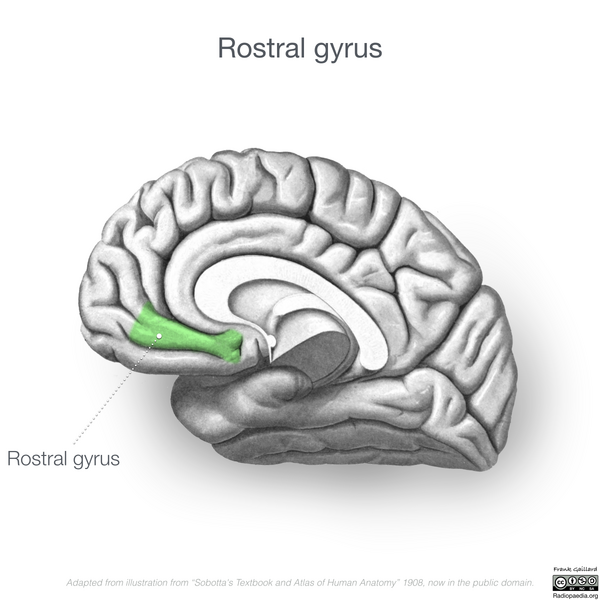 File:Neuroanatomy- medial cortex (diagrams) (Radiopaedia 47208-52697 Rostral gyrus 2).png