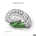 Neuroanatomy- medial cortex (diagrams) (Radiopaedia 47208-51763 Temporal lobe 3).png