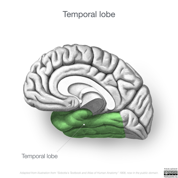 File:Neuroanatomy- medial cortex (diagrams) (Radiopaedia 47208-51763 Temporal lobe 3).png
