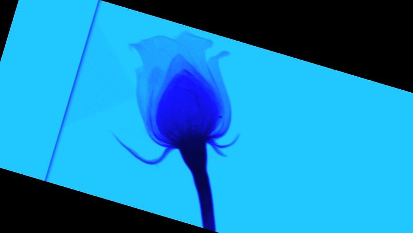 Blue rose (Radiopaedia 23430-23511 A 114).jpg