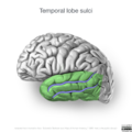 Neuroanatomy- lateral cortex (diagrams) (Radiopaedia 46670-51201 Temporal lobe 3).png