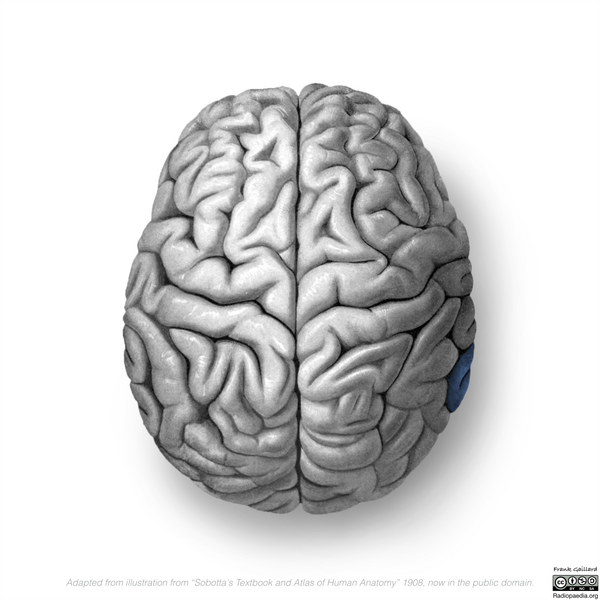 File:Neuroanatomy- superior cortex (diagrams) (Radiopaedia 59317-66671 Angular gyrus 3).png