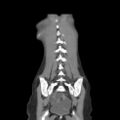 Colocolic fistula - Crohn disease (Radiopaedia 57063-63955 B 39).jpg