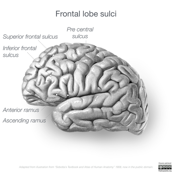 File:Neuroanatomy- lateral cortex (diagrams) (Radiopaedia 46670-51201 C 4).png