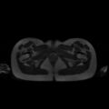Normal MRI abdomen in pregnancy (Radiopaedia 88001-104541 Axial T2 74).jpg