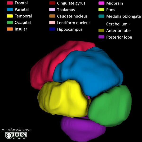 File:Brain lobes - annotated MRI (Radiopaedia 61691-69700 3D reconstruction 51).JPG