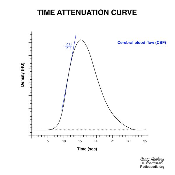 File:Brain perfusion - time attenuation curves (Radiopaedia 70313-80395 CBF 1).jpeg