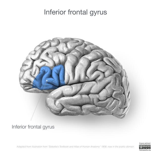 File:Neuroanatomy- lateral cortex (diagrams) (Radiopaedia 46670-51313 E 1).png