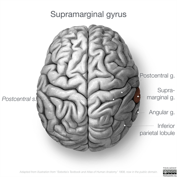 File:Neuroanatomy- superior cortex (diagrams) (Radiopaedia 59317-66671 Supramarginal gyrus 1).png