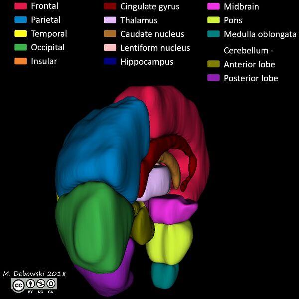 File:Brain lobes - annotated MRI (Radiopaedia 61691-69700 3D reconstruction 70).JPG