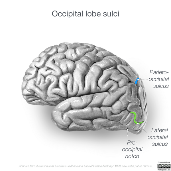 File:Neuroanatomy- lateral cortex (diagrams) (Radiopaedia 46670-51201 I 1).png