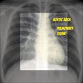 Chest x-ray - circulation (Radiopaedia 32664-33633 D 1).jpg