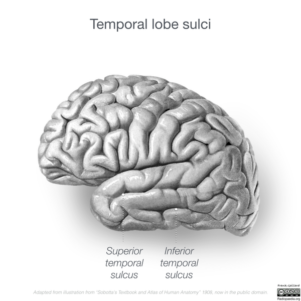 File:Neuroanatomy- lateral cortex (diagrams) (Radiopaedia 46670-51201 G 4).png