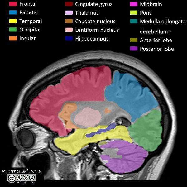 File:Brain lobes - annotated MRI (Radiopaedia 61691-69700 Sagittal 56).JPG