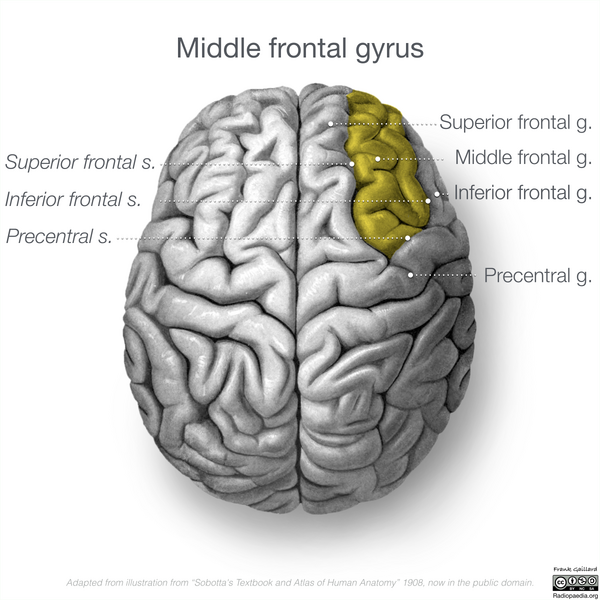 File:Neuroanatomy- superior cortex (diagrams) (Radiopaedia 59317-66670 Middle frontal gyrus 1).png