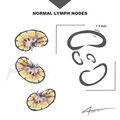 Normal and pathological axillary lymph nodes (Radiopaedia 84164-99438 A 1).jpeg