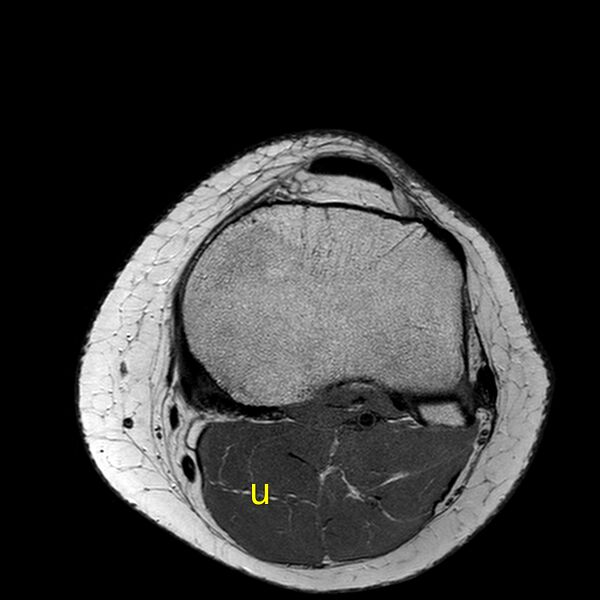 File:Anatomy Quiz (MRI knee) (Radiopaedia 43478-46866 A 22).jpeg