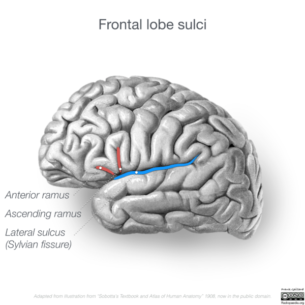 File:Neuroanatomy- lateral cortex (diagrams) (Radiopaedia 46670-51202 C 7).png