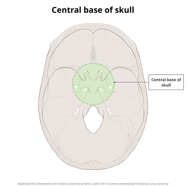 File:Base of skull (illustrations) (Radiopaedia 59251-66592 A 3).png