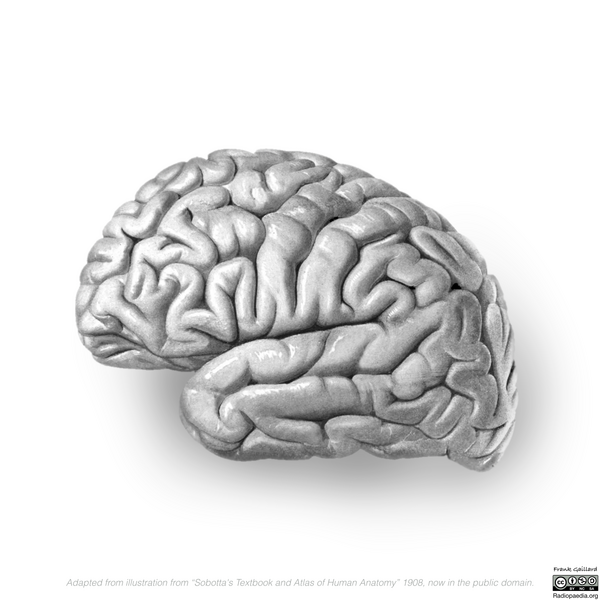 File:Neuroanatomy- lateral cortex (diagrams) (Radiopaedia 46670-51156 Lobes 1).png