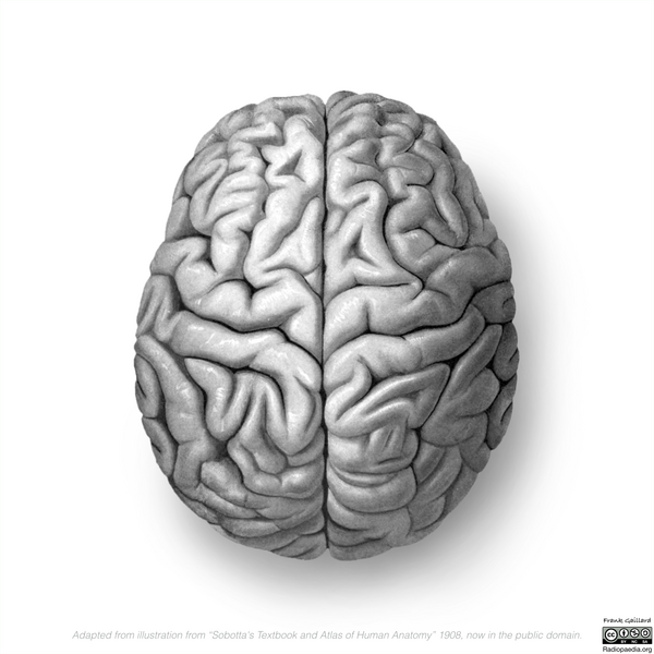File:Neuroanatomy- superior cortex (diagrams) (Radiopaedia 59317-66668 C 1).png