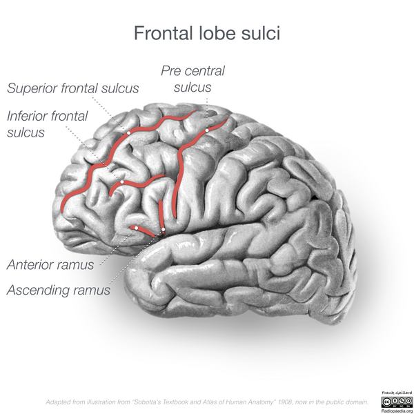 File:Neuroanatomy- lateral cortex (diagrams) (Radiopaedia 46670-51201 C 3).png