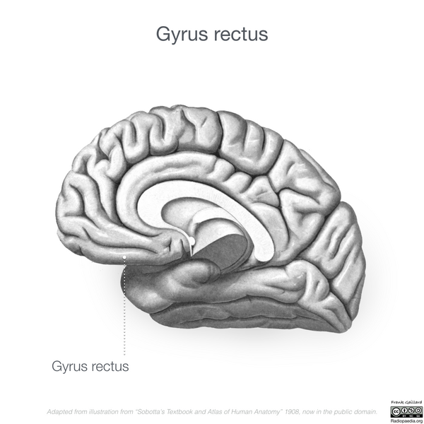 File:Neuroanatomy- medial cortex (diagrams) (Radiopaedia 47208-52697 Gyrus rectus 5).png