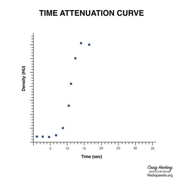 File:Brain perfusion - time attenuation curves (Radiopaedia 70313-80395 Curve generation 11).jpeg