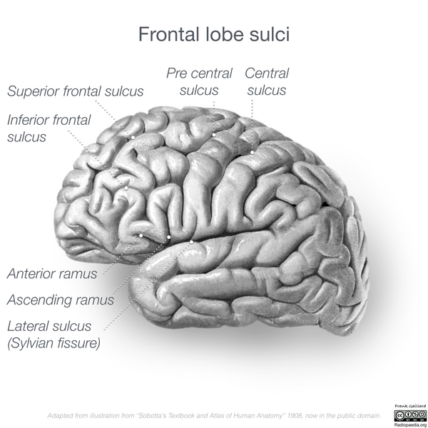 File:Neuroanatomy- lateral cortex (diagrams) (Radiopaedia 46670-51201 C 2).png