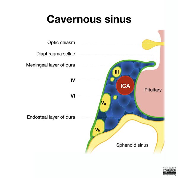 File:Cavernous sinus (illustration) (Radiopaedia 54907-61184 A 1).jpeg