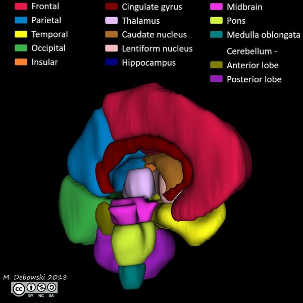 File:Brain lobes - annotated MRI (Radiopaedia 61691-69700 3D reconstruction 8).JPG